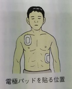 aed
pad